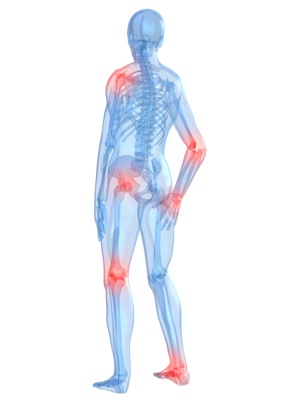Osteoarthritis causes many symptoms and glucosamine helps if you choose the right quality