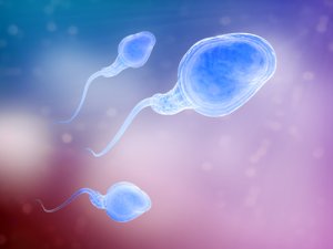 Poor sperm quality is a frequent cause of infertility