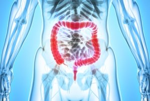  Vitamin D may relieve irritable bowel syndrome (IBS)