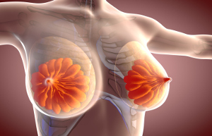 Brist på omega-3 ökar risken för bröstcancer