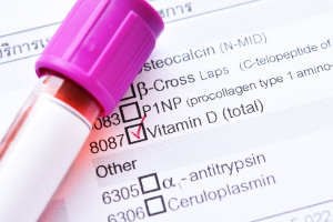D-vitaminnivån är avgörande för huruvida covid-19 är ofarligt eller livshotande