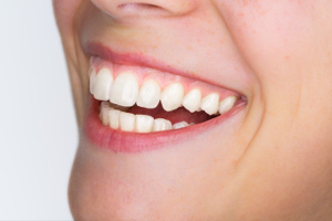 D-vitamins betydning for tandsundheden