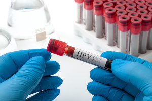 Fünf Antioxidantien können HPV-Infektionen reduzieren, die mit Gebärmutterhalskrebs in Verbindung stehen