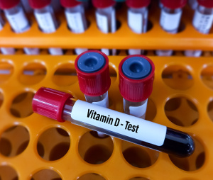 Taking vitamin D can lower your melanoma risk by 50 percent