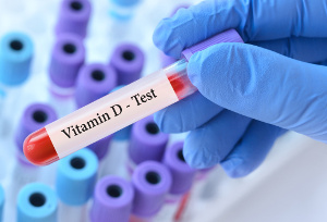 Patienter med ledgångsreumatism under Metotrexatbehandling har lägre dödlighet vid höga D-vitaminnivåer
